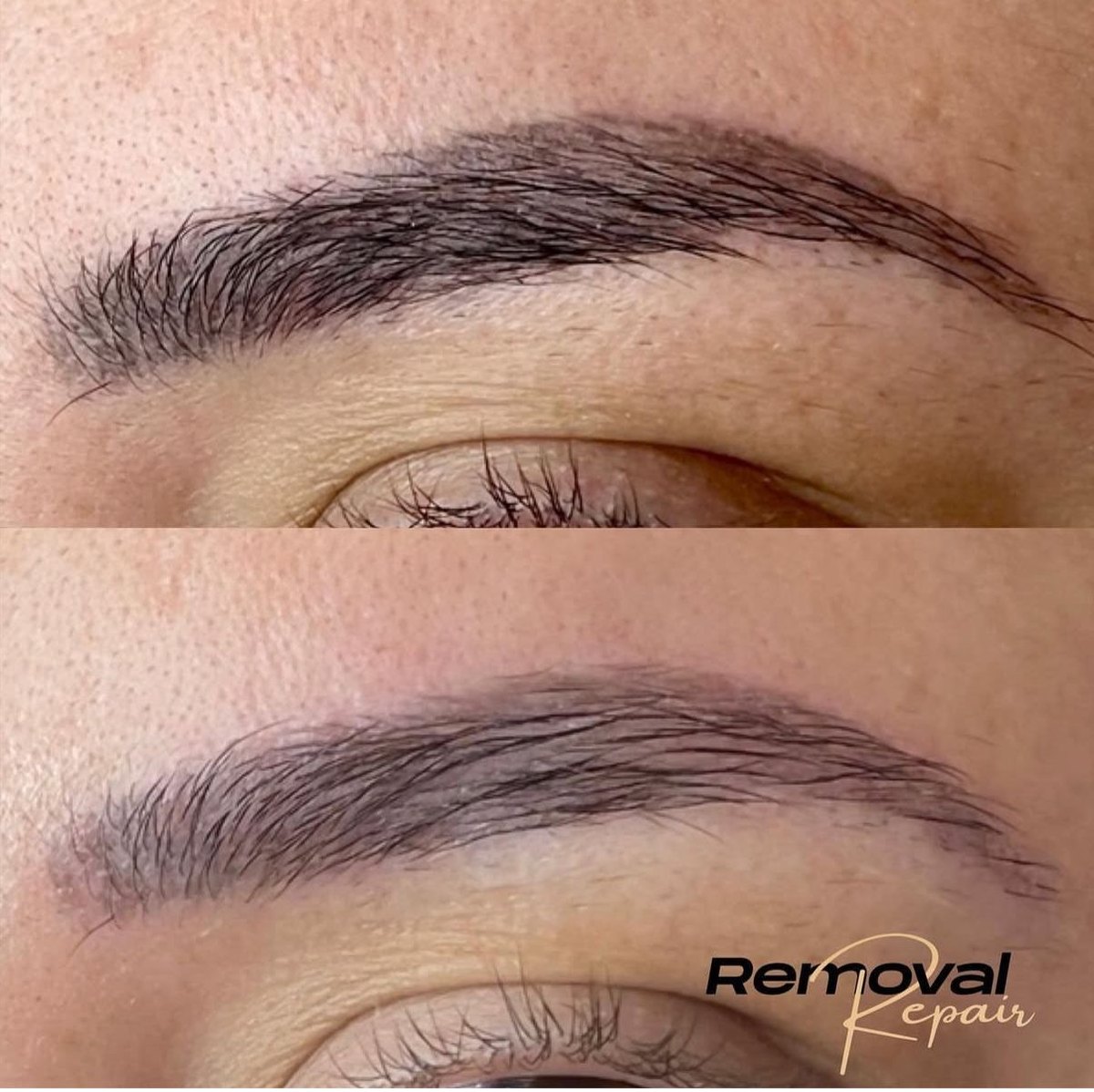 Sobrancelhas antes e depois do procedimento