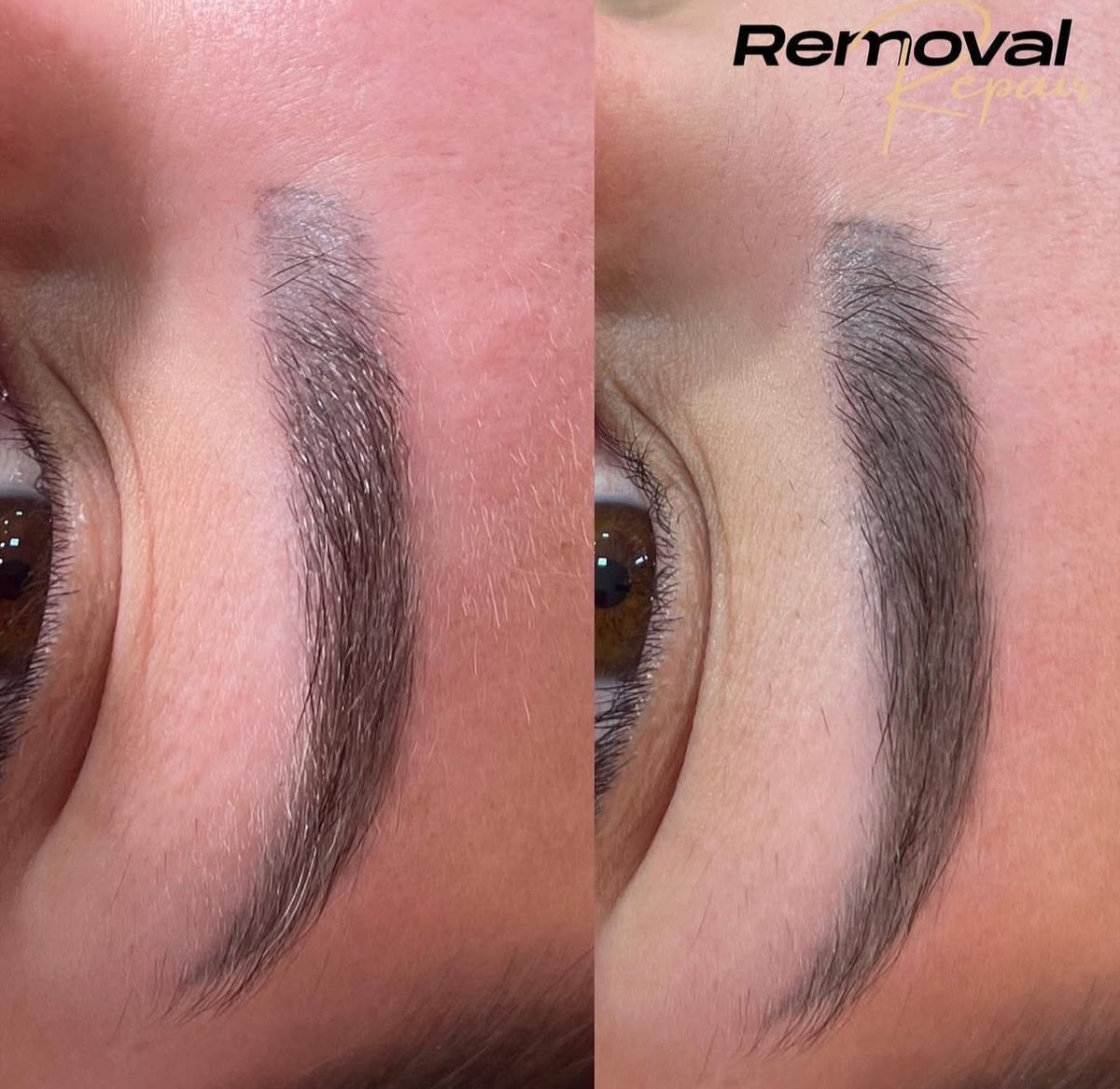 Sobrancelhas antes e depois do procedimento