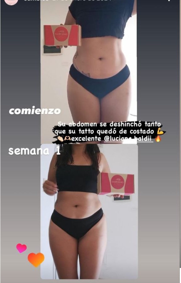 Abdomen deshinchado