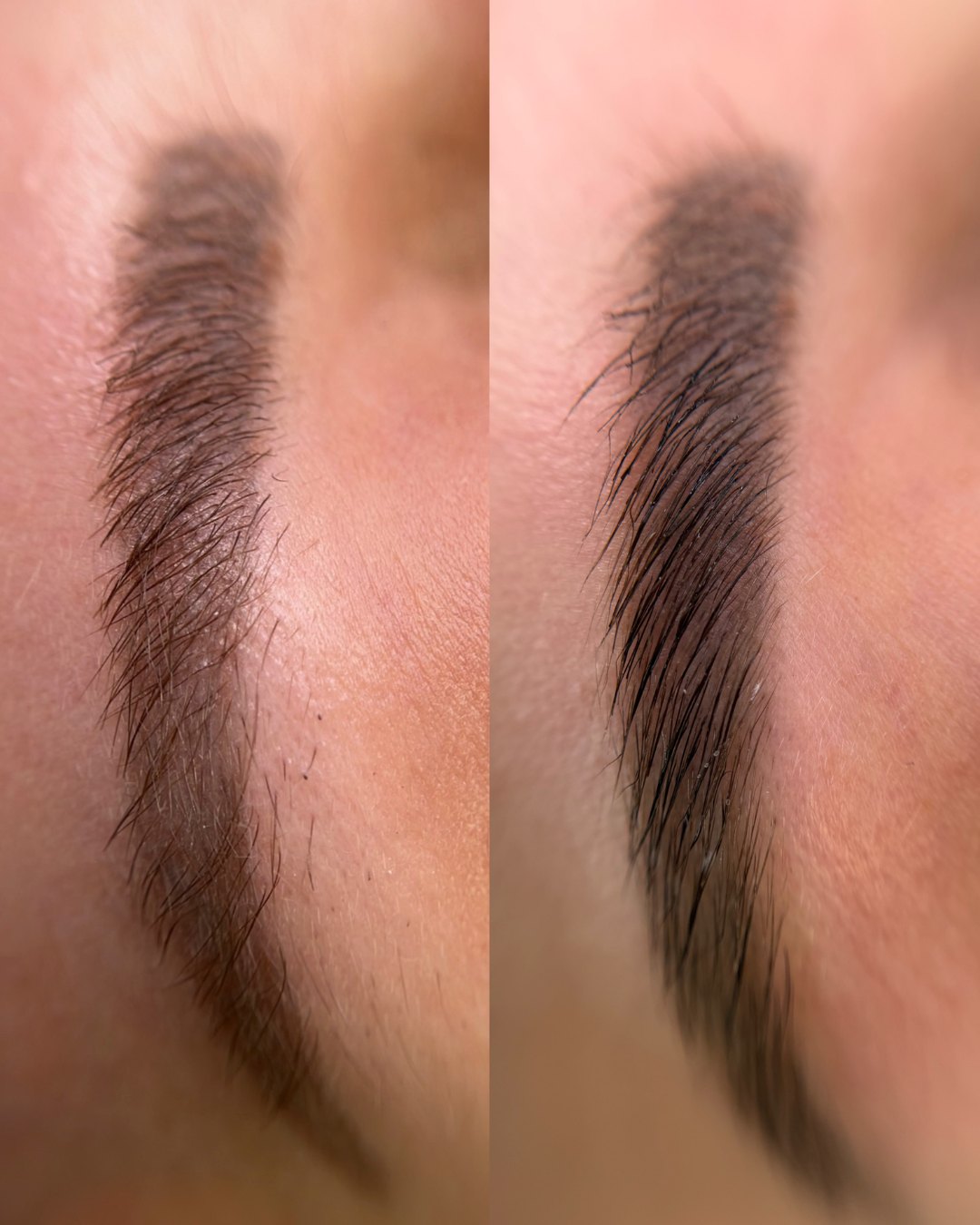 Sobrancelhas antes e depois do procedimento