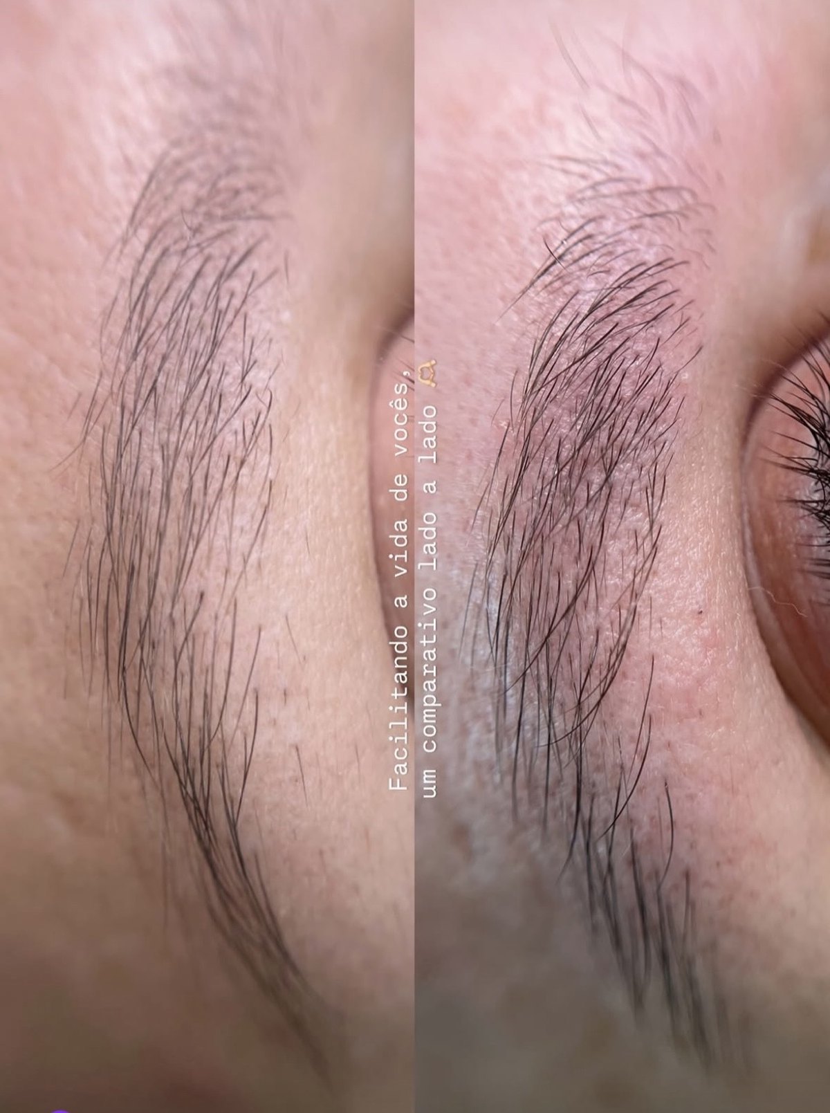 Sobrancelhas antes e depois do procedimento