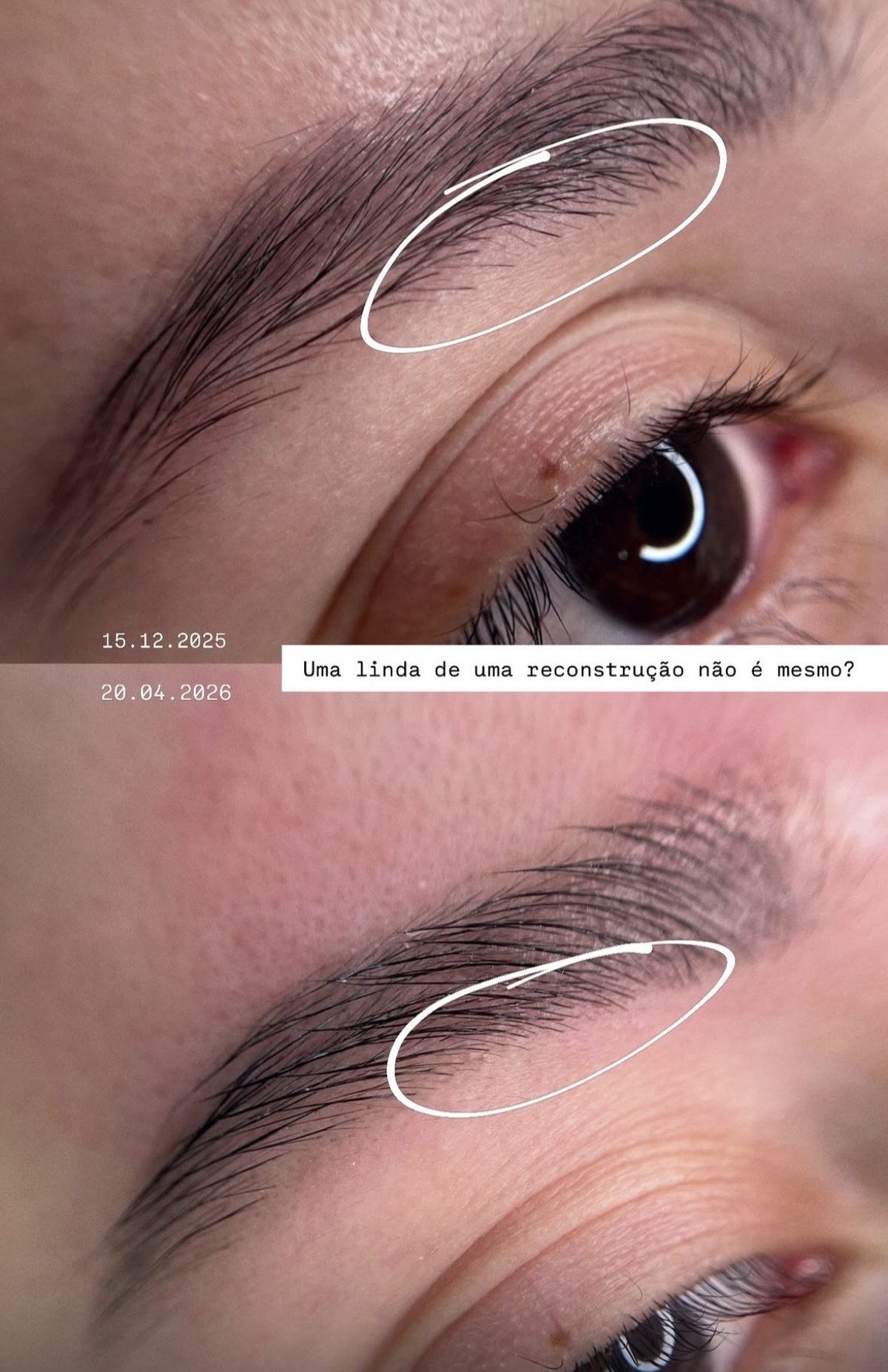 Sobrancelhas antes e depois do procedimento
