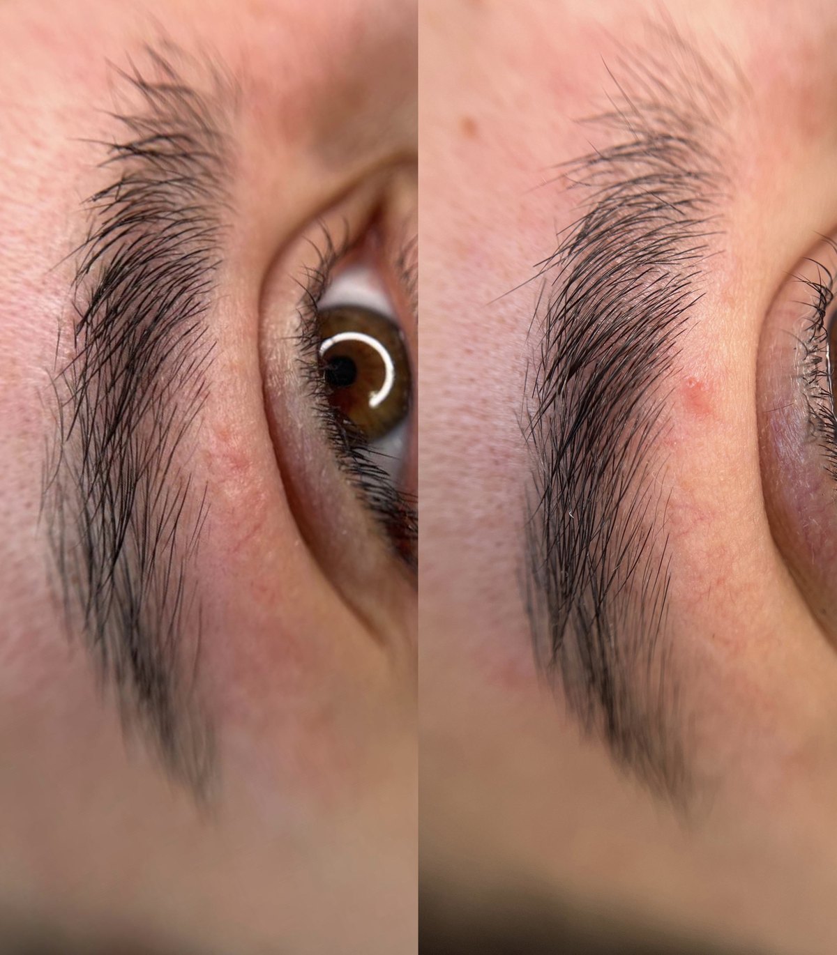 Sobrancelhas antes e depois do procedimento