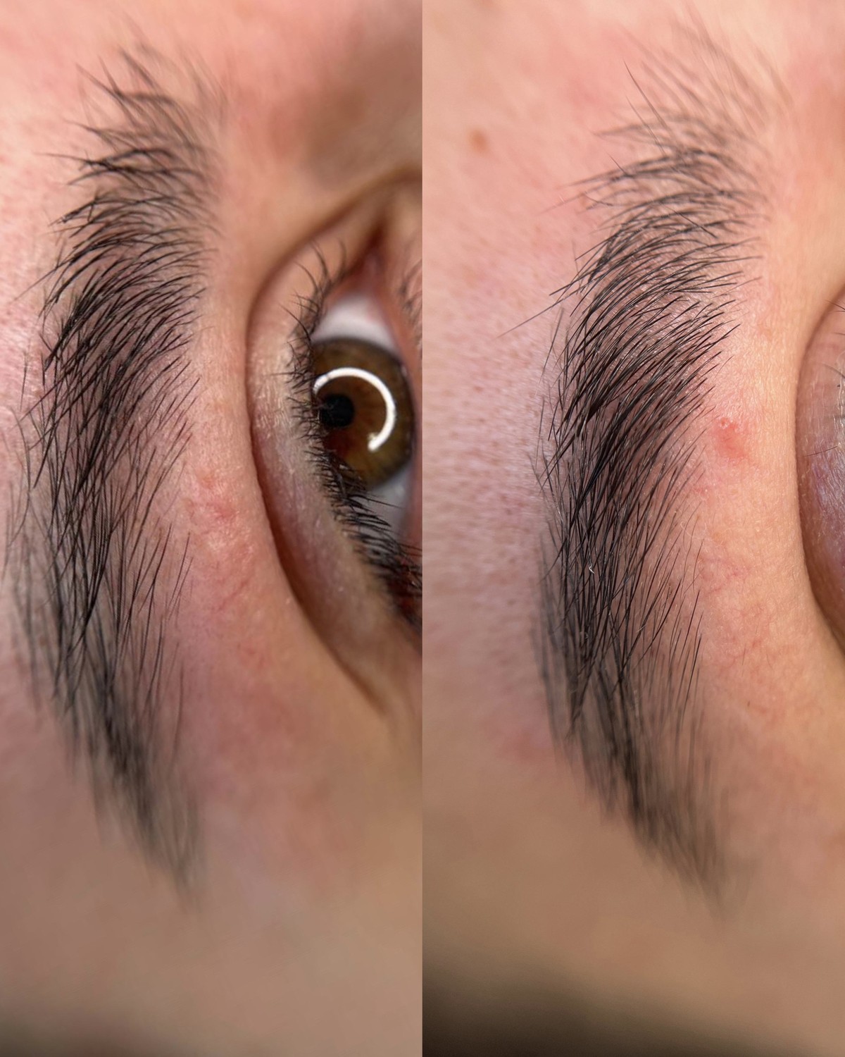 Sobrancelhas antes e depois da reconstrução com Nano Therapy