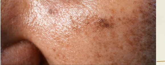 Manchas solares