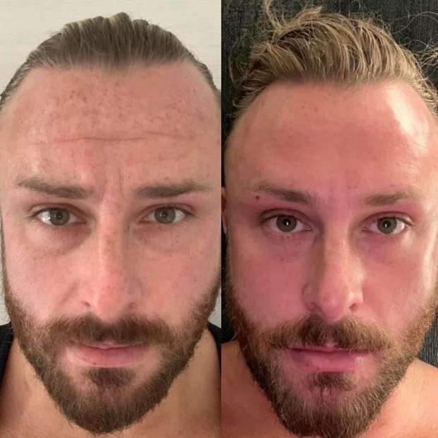 El antes y despu&eacute;s de Marcelo, 42 a&ntilde;os