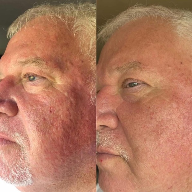 El antes y despu&eacute;s de Gustavo, 65 a&ntilde;os