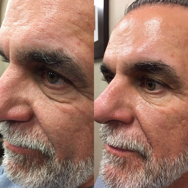 El antes y despu&eacute;s de Daniel, 56 a&ntilde;os