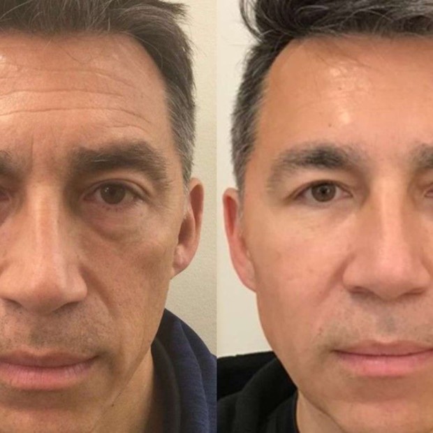 El antes y despu&eacute;s de Ricardo, 53 a&ntilde;os
