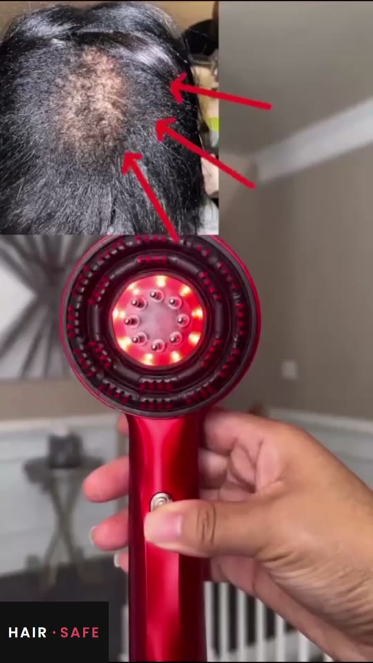HairSafe en uso — video 4